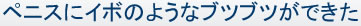 ペニスにイボのようなブツブツができた