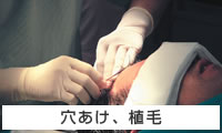 穴あけ、植毛