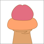 腫れてしまったカントン包茎