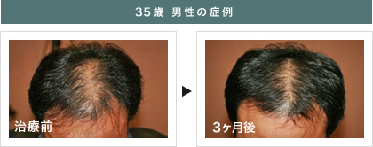 35歳男性の症例