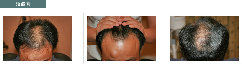治療前の写真