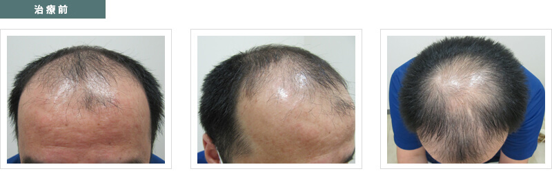 治療前の写真