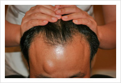 HARG+治療の症例