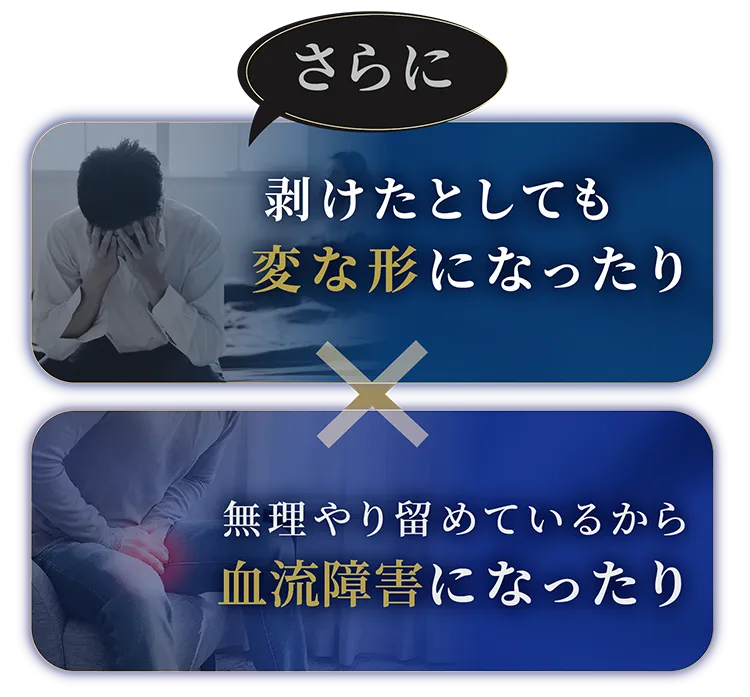 切る包茎治療がおすすめの理由