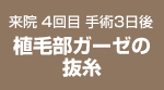来院 4回目 手術3日後 植毛部ガーゼの抜糸