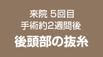 来院 4回目 手術後約2週間後 後頭部の抜歯