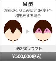 M型 左右のそりこみ部分(M字)へ移植をする場合 約260グラフト 500,000