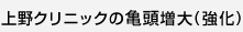 上野クリニックの亀頭増大(強化)