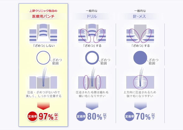 ホール穿孔時の「ざめつ」範囲比較