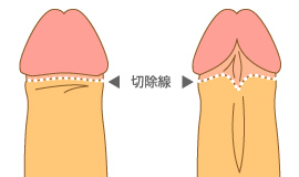複合曲線作図法