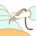 オペのイメージ