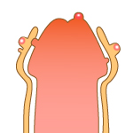 ペニスに水疱ができた