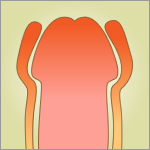 ペニスが腫れた