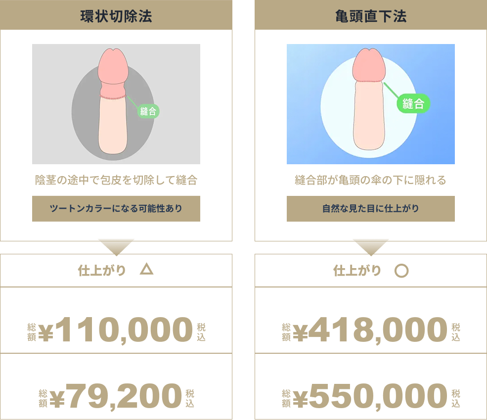 環状切除法と亀頭直下法の料金比較