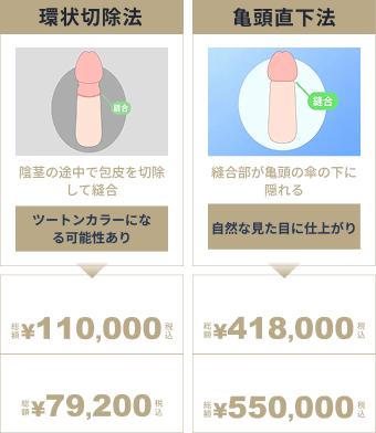環状切除法と亀頭直下法の料金比較