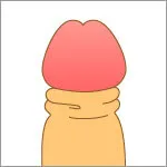 カントン包茎のイメージ