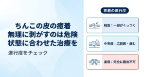 ちんこの皮が癒着していても大丈夫？原因・リスクと正しい対処法を解説