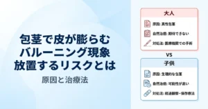 包茎で排尿時に皮が膨らむ「バルーニング現象」の原因とリスク・治療法