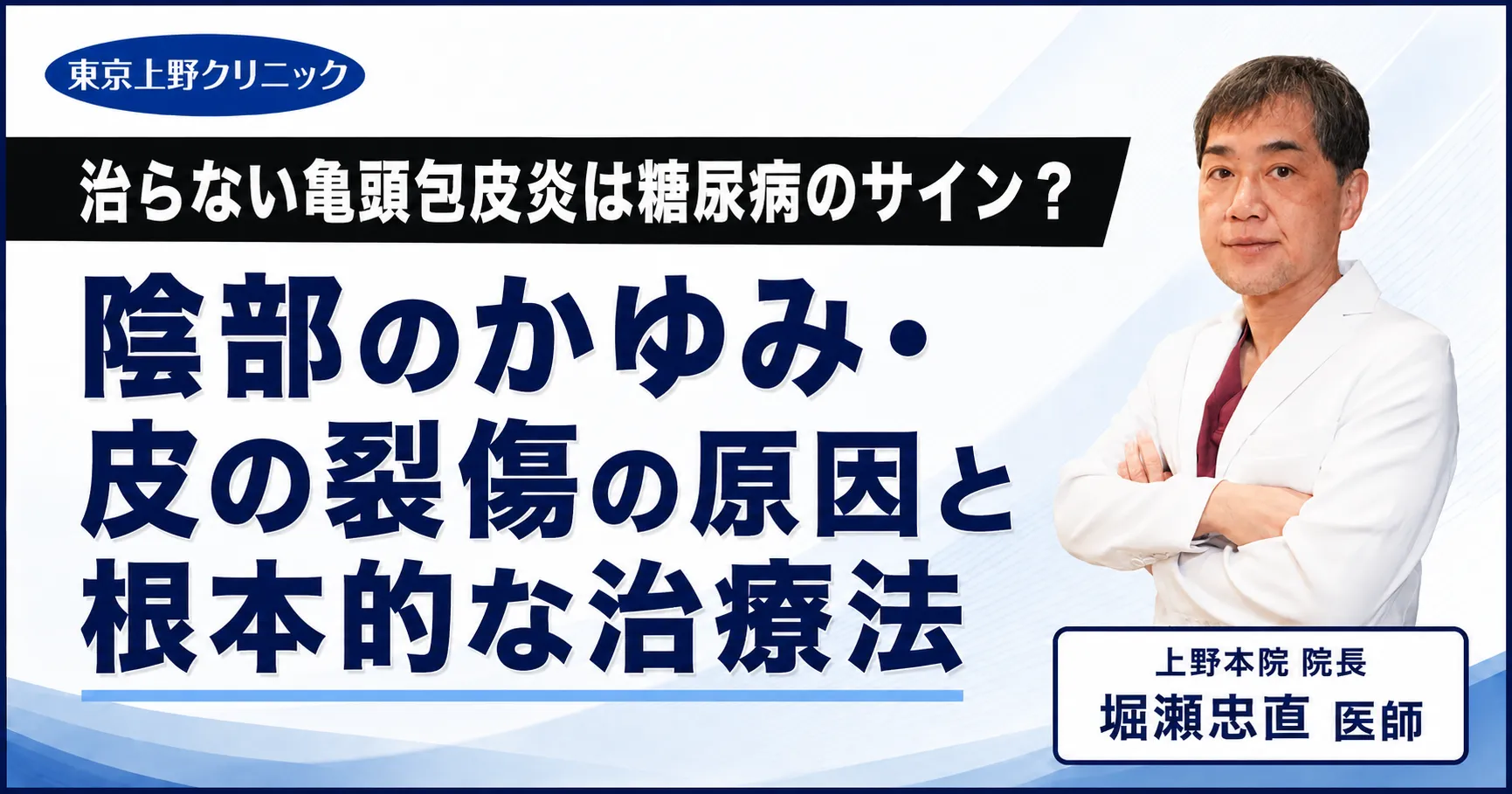 治らない亀頭包皮炎は糖尿病のサイン?陰部のかゆみ・皮の裂傷の原因と根本的な治療法