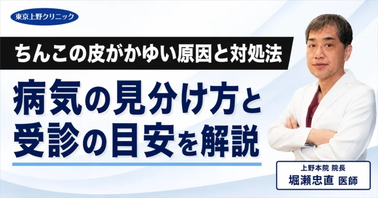 ちんこの皮がかゆい原因と対処法｜病気の見分け方と受診の目安を解説