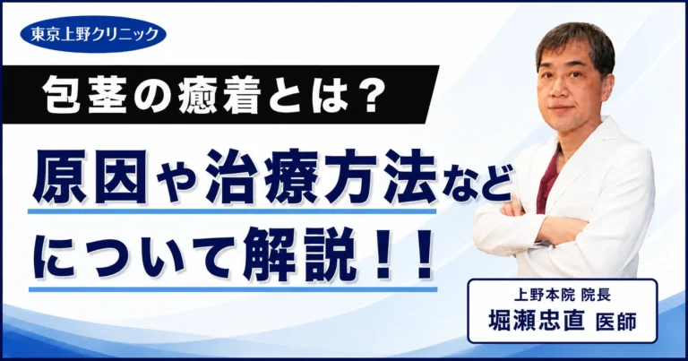 包茎の癒着とは？原因や治療方法などについて解説！！