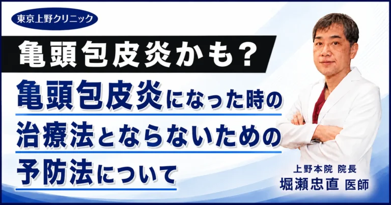 亀頭包皮炎かも？亀頭包皮炎になった時の治療法とならないための予防法について