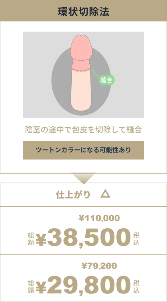 環状切除法の値段