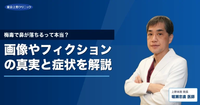 梅毒で鼻が落ちるって本当？画像やフィクションの真実と症状を解説