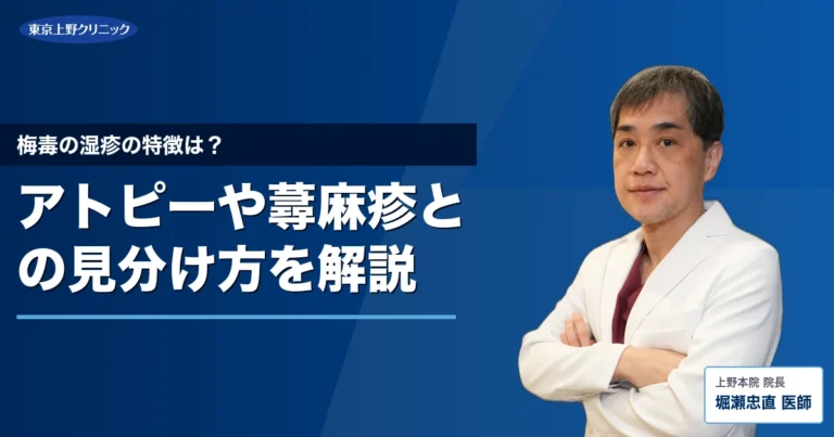 梅毒の湿疹の特徴は？アトピーや蕁麻疹との見分け方を解説