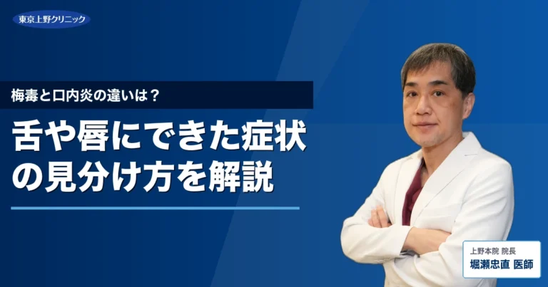 梅毒と口内炎の違いは？舌や唇にできた症状の見分け方を解説