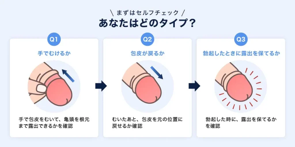 まずはセルフチェック｜あなたはどのタイプ？の説明
