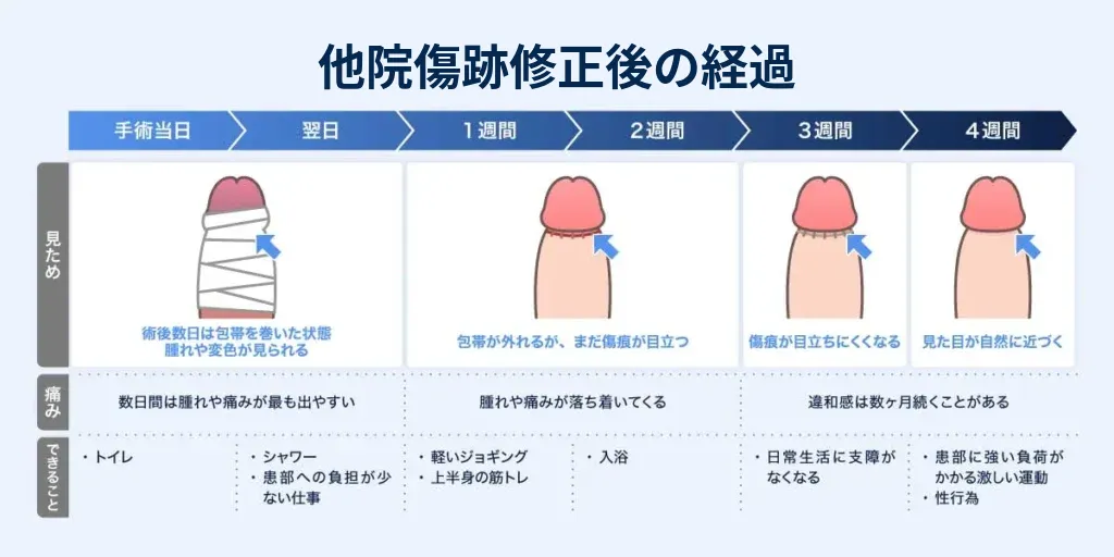 他院傷痕修正後の経過の説明