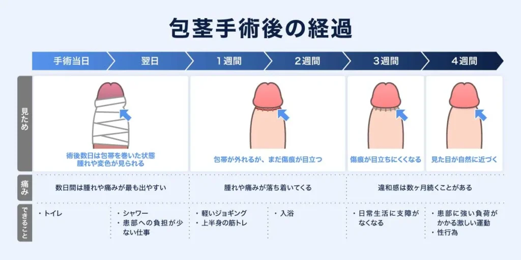 包茎手術の経過の説明