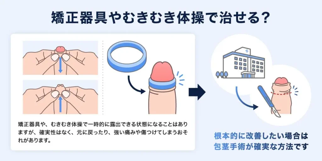 矯正器具やむきむき体操で治せる？の説明