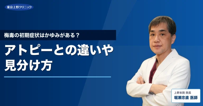 梅毒の初期症状はかゆみがある？アトピーとの違いや見分け方