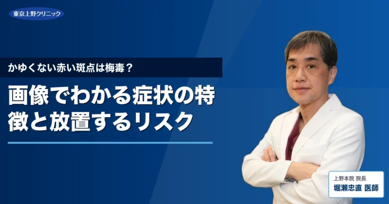 かゆくない赤い斑点は梅毒？画像でわかる症状の特徴と放置するリスク